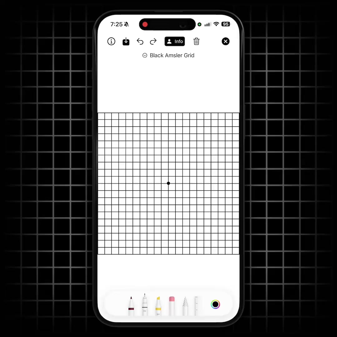 Amsler Grid Macular Degeneration Screening Test