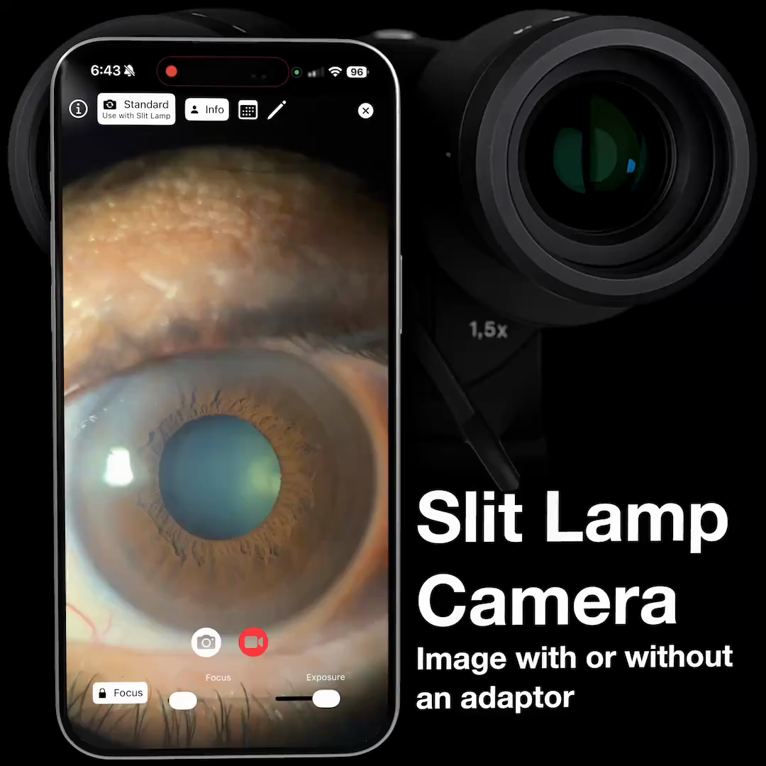 Slit Lamp Camera Ophthalmology Tool Preview